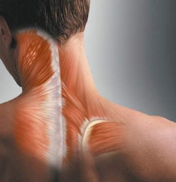 Muscle Spasm